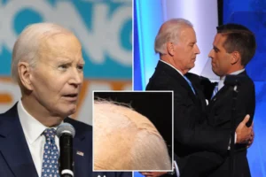 DEMENTED HEAD CASE: Bandaged-up Biden says son Beau ‘should’ve been the president, not me’ in speech ripping Trump