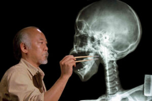 For 8 years, this Chinese dude had a 12-inch metal chopstick stuck in his throat, but finally got it removed