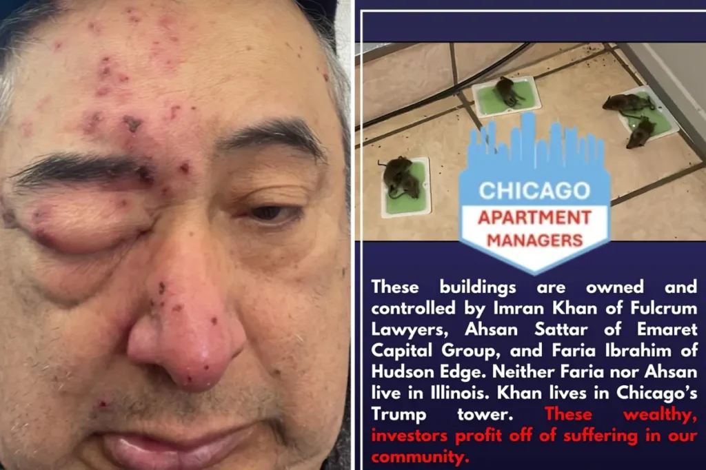 Democrat City of Chicago renter woke up to rats gnawing on his face after complaining about infestation to landlord for months