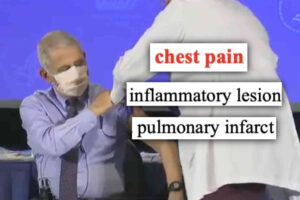 Fauci’s diary says he got a blood clot in his lung a few months after his Covid shot, but he never told anyone 😬