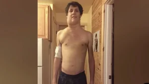 WATCH: Tennessee Teen Drenched in Glyphosate Spent Next 7 Years Fighting ‘Massive Alien’ Tumor