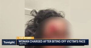 DEMOCRAT CITY HORROR: ‘Zombie’ Attacker Bites Chunk of Woman’s Face Off in Seattle in Racially Motivated Attack