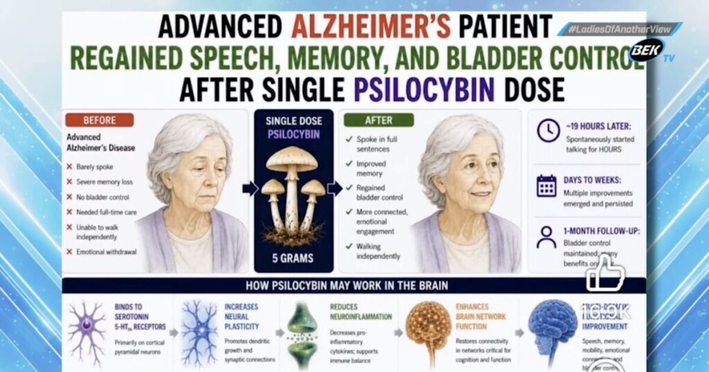 SHOCK CASE REPORT: Advanced Alzheimer’s Patient Regains Speech, Memory, Mobility, and Bladder Control After a Single High Dose of Psilocybin-Containing Mushrooms